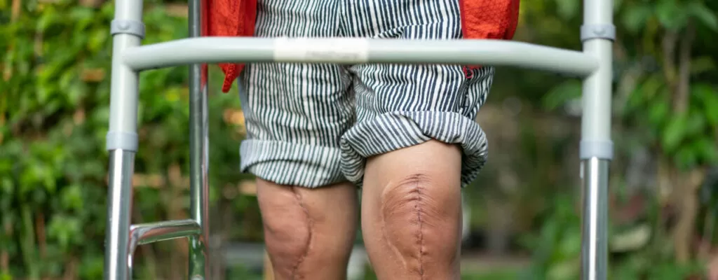 Post operative exercise for knee pain in New Jersey